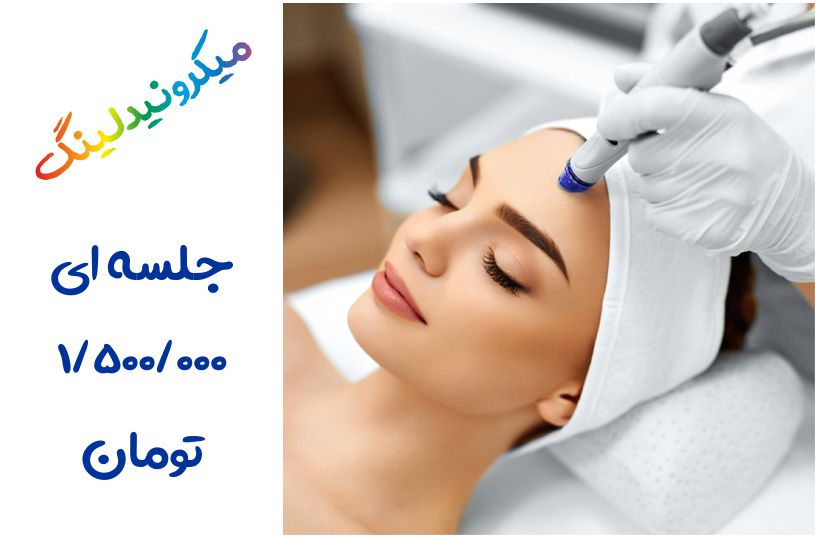 میکرونیدلینگ